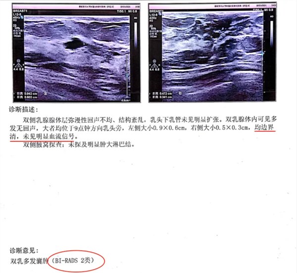 体检每 3 人就有 1 人中招，但你真的不用慌